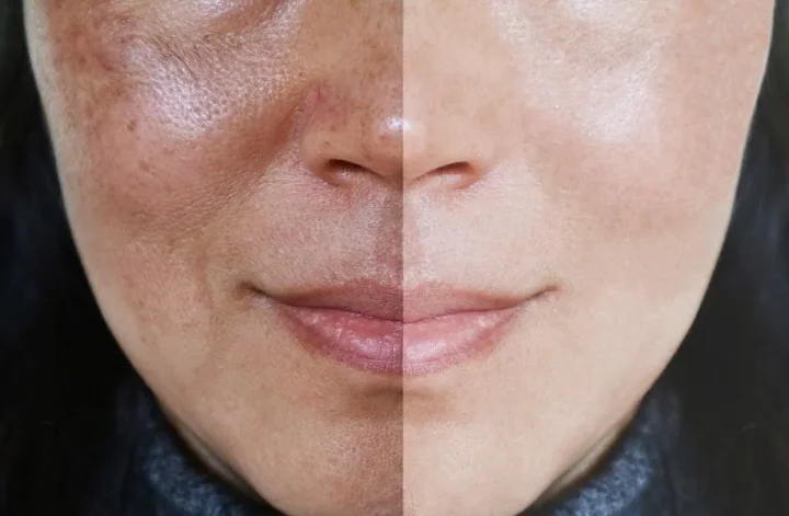 dull skin artinya