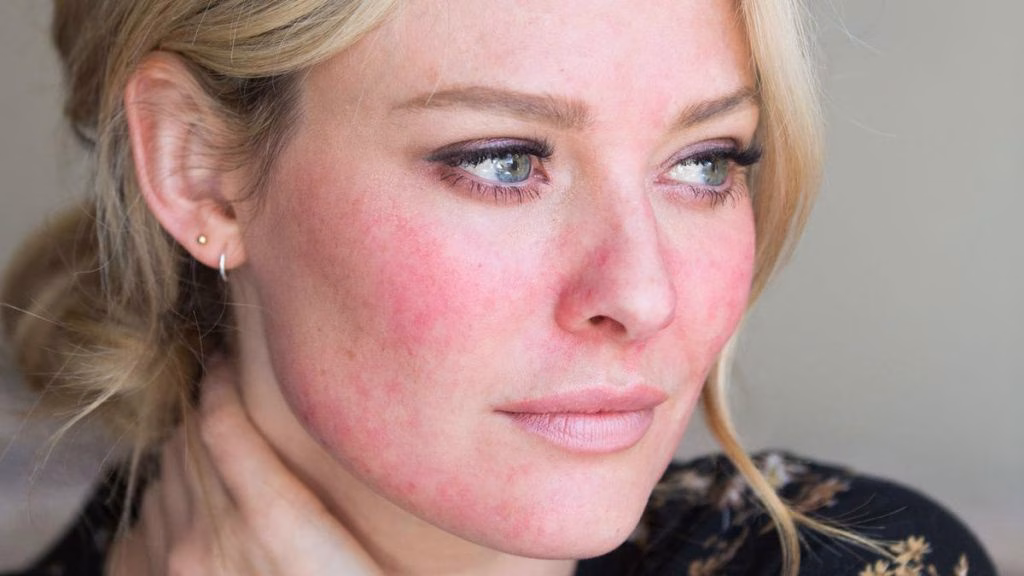kenapa pakai sunscreen muka jadi merah