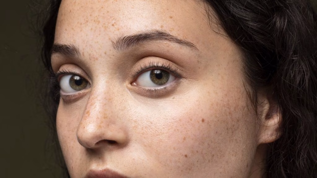 cara agar flek hitam di wajah cepat mengelupas