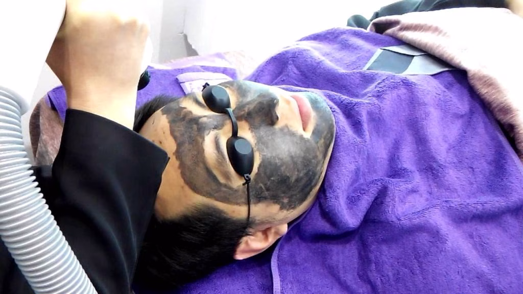 laser black doll berapa kali sebulan