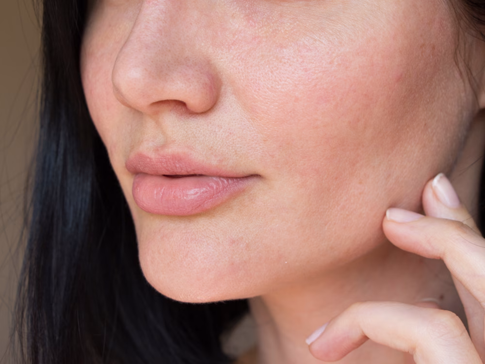 Dry Skin Artinya: Mengapa Kulitmu Terasa Kasar dan Cara Mengatasinya dengan Lembut