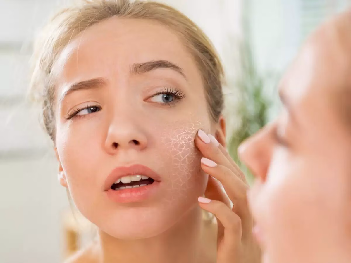 Skincare untuk Kulit Kering yang Lembap dan Nyaman Sepanjang Hari