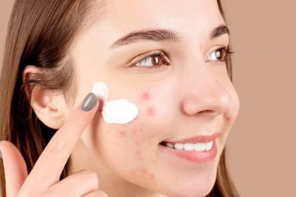 Skincare untuk Menghilangkan Flek Hitam yang Efektif dan Aman untuk Kulitmu