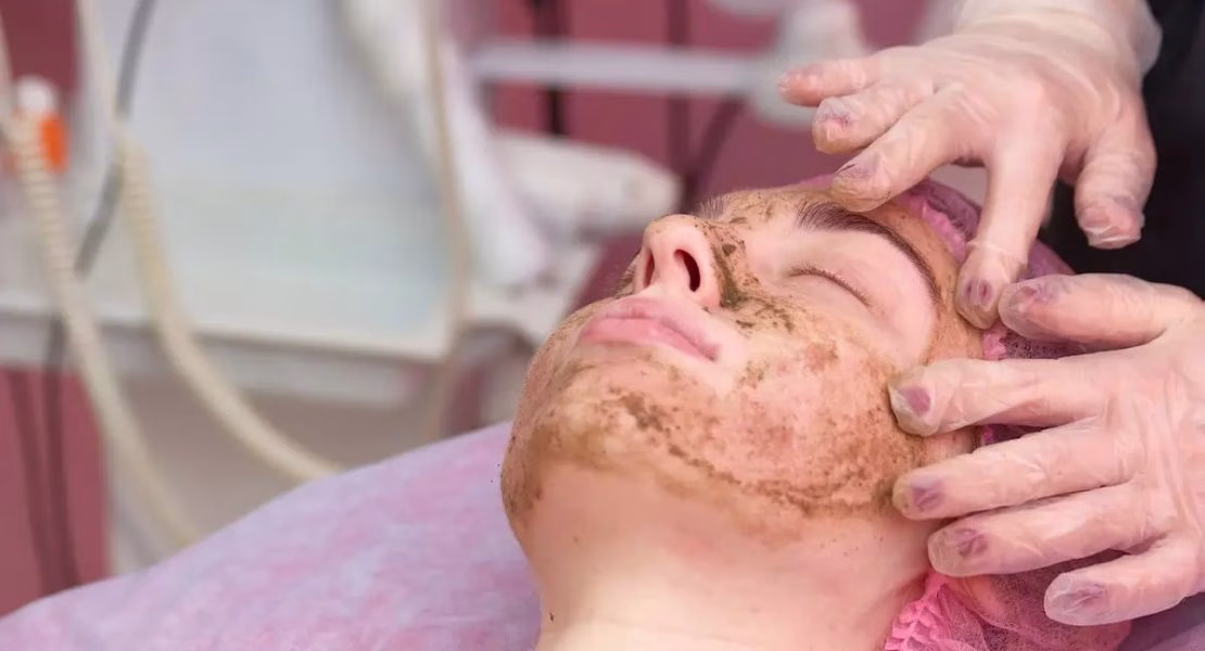 Efek Setelah Peeling Wajah yang Perlu Kamu Ketahui