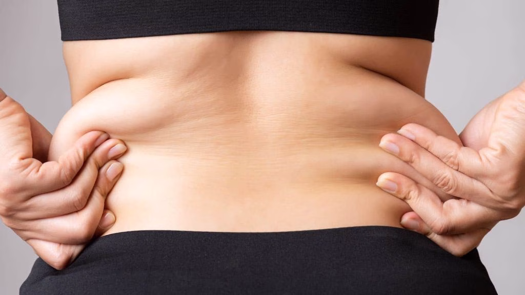 Excess Skin: Apa yang Terjadi pada Kulit Setelah Penurunan Berat Badan Signifikan