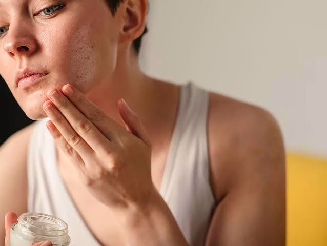 Rahasia Acne Skincare yang Membuat Kulit Berjerawat Lebih Bersih dan Percaya Diri
