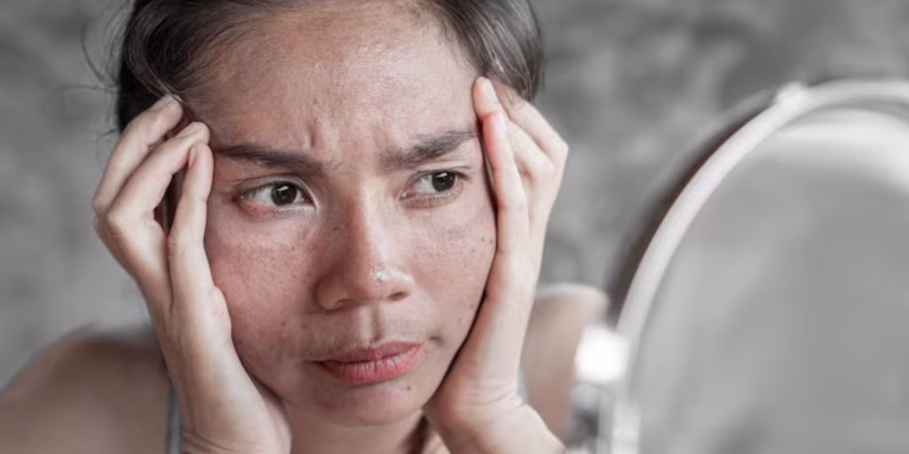 Ciri Wajah Kusam yang Sering Muncul di Foto Selfie