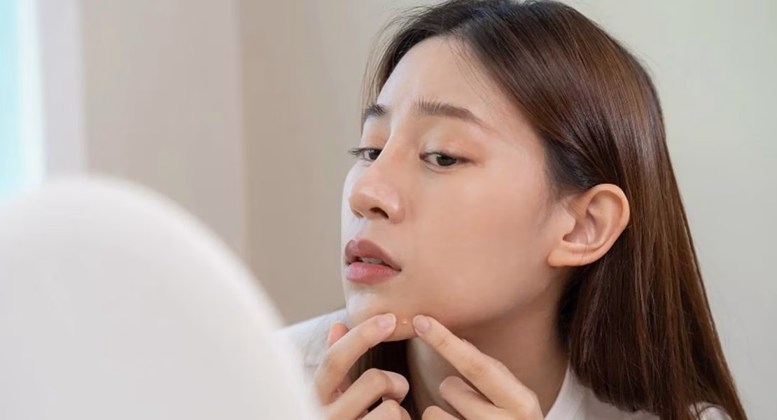 Efek Begadang Bagi Wajah yang Bisa Terlihat Hanya dalam Satu Malam