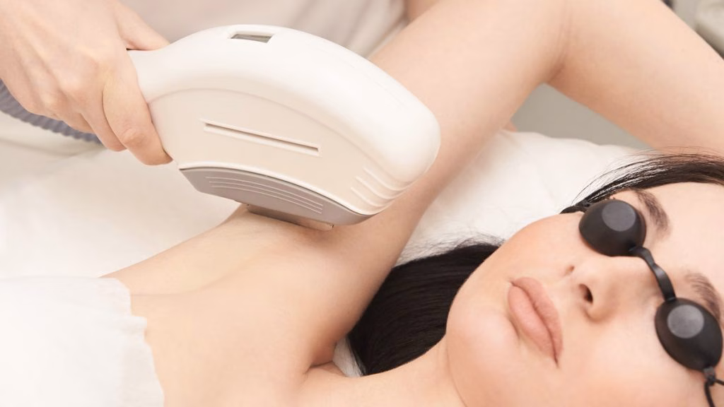 Pantangan Setelah IPL Underarm yang Perlu Diperhatikan dengan Baik