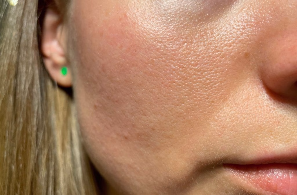 Pore Tightening Artinya dan Cara Mengencangkan Pori Kulit agar Wajah Tampak Lebih Halus