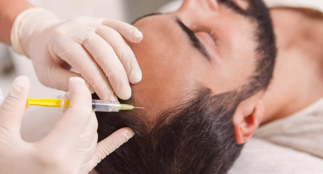 PRP Treatment Adalah Rahasia Kulit Alami yang Semakin Banyak Orang Cari