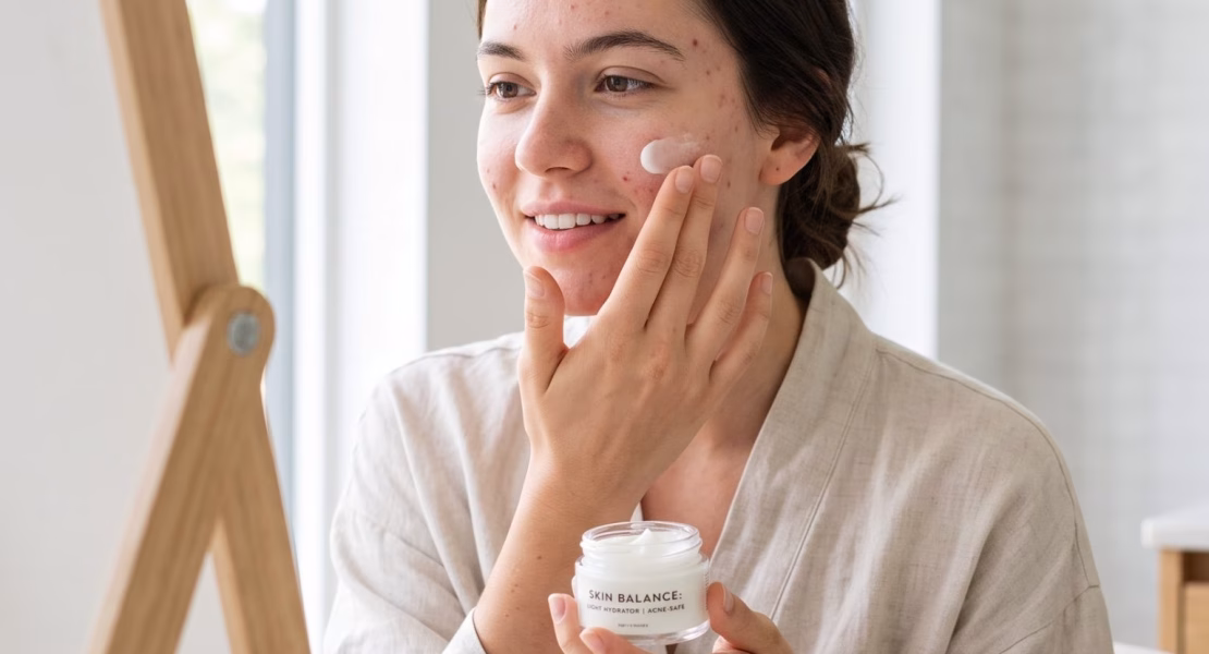 Moisturizer Jerawat: Bolehkah Kulit Berjerawat Pakai Pelembap?