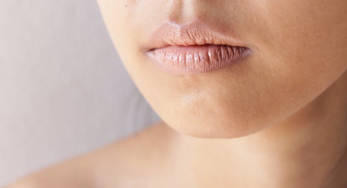 Cara Mengatasi Bibir Kering yang Sering Diabaikan