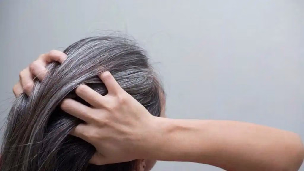 Cara Menghilangkan Uban dengan Langkah Praktis di Rumah
