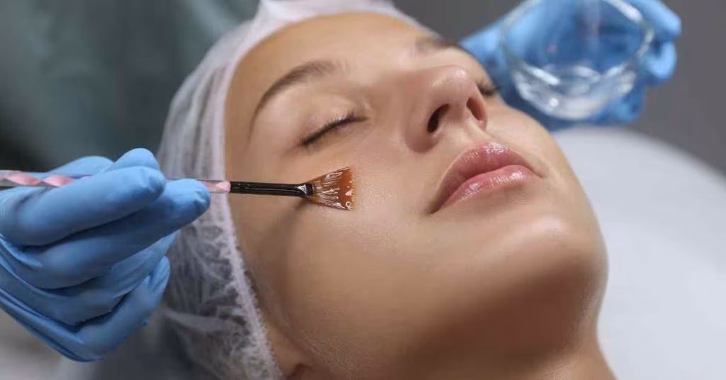 Chemical Peeling untuk Kulit yang Lebih Cerah dan Halus